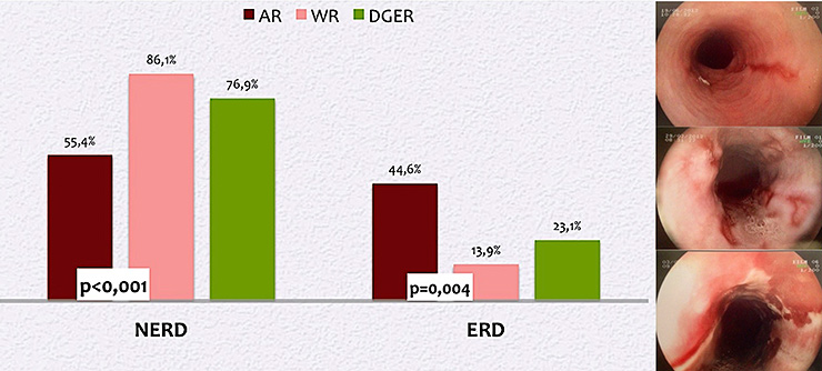 Fig. I. Results of upper-GI endoscopy in GERD patients with different types of reflux